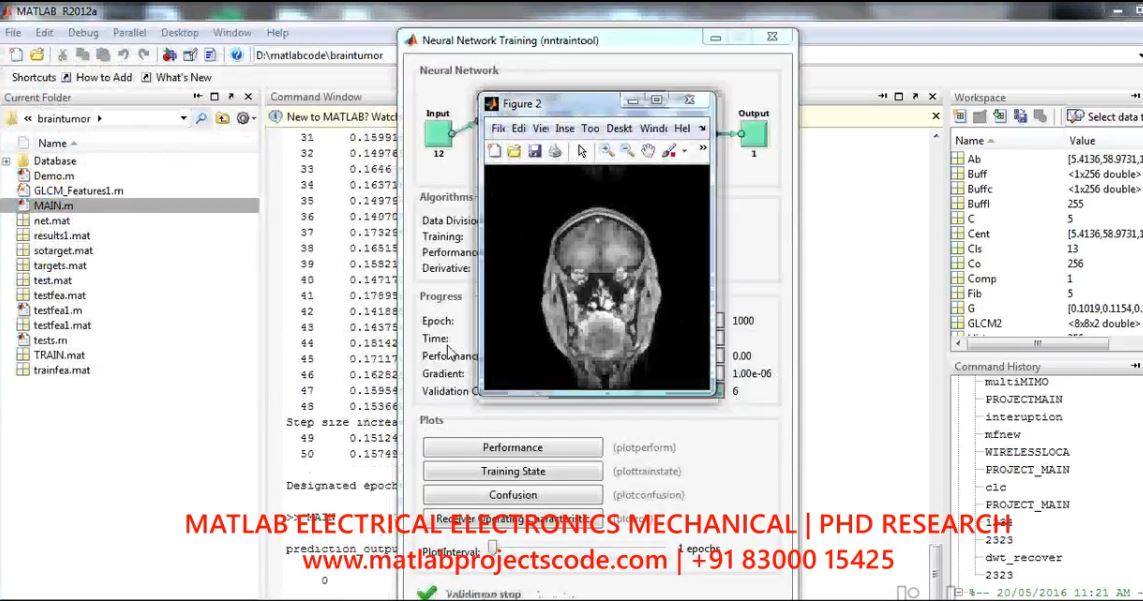 Brain Tumour Classification In Magnetic Resonance Mr Images Using Glcm And Probabilistic Neural Network project simulation thumbnail for Signal Processing and AI Engineering